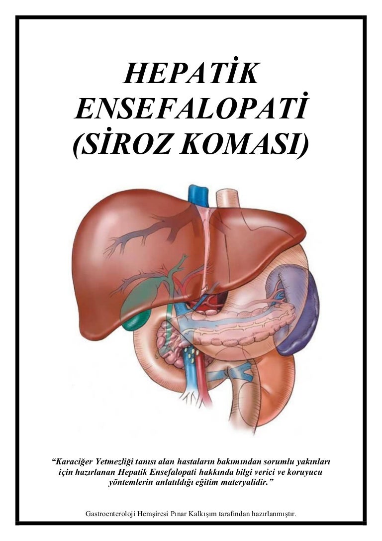 Karaciğer Yetmezliği Karaciğer Yetmezliği
